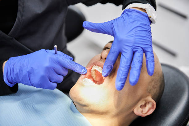 Best Emergency Treatment for Dental Infections or Abscesses in Sanford, FL